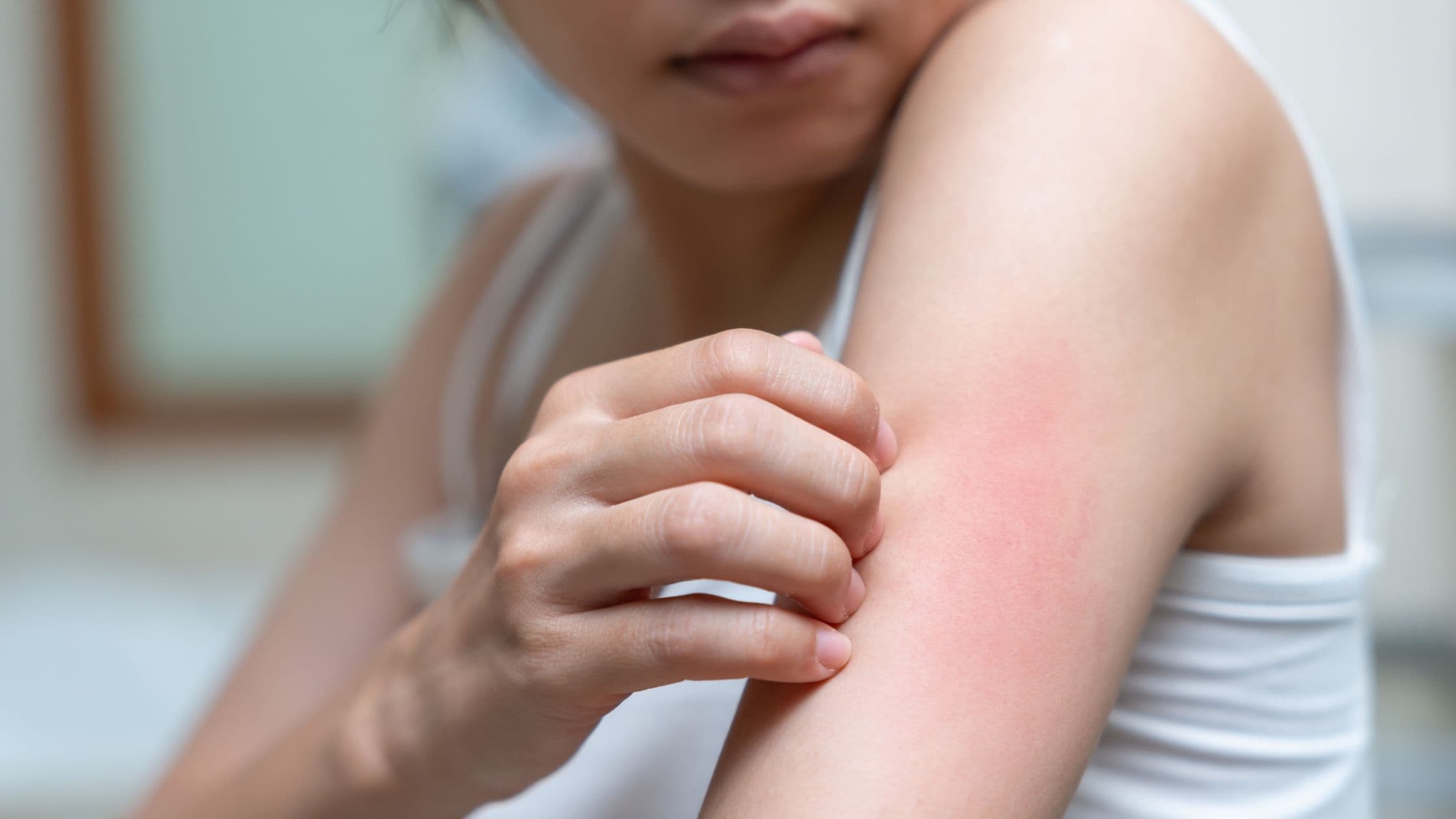 a woman is scratching her arm with her hand .