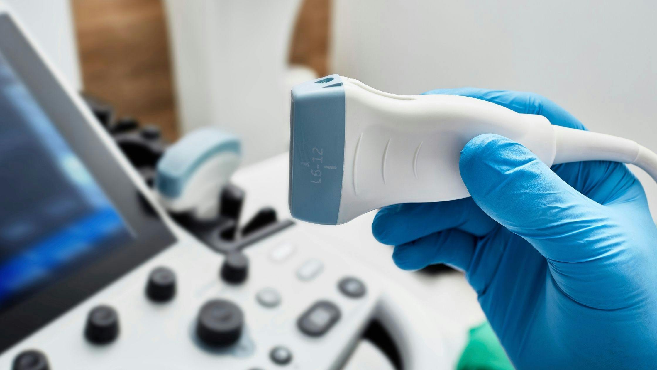 a person wearing blue gloves is holding an ultrasound probe in their hand .