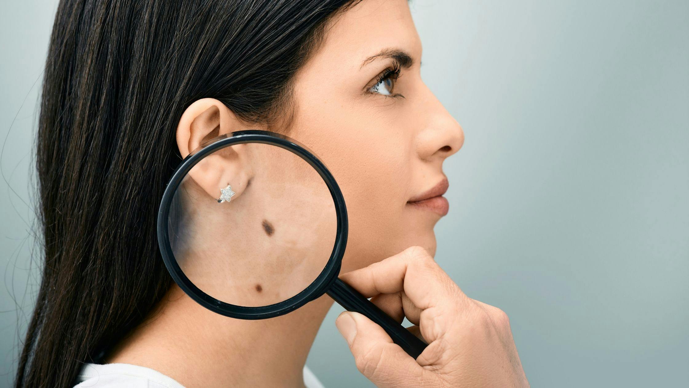 a woman is looking at a mole on her neck with a magnifying glass .