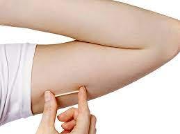 a woman is holding a contraceptive device in her arm .