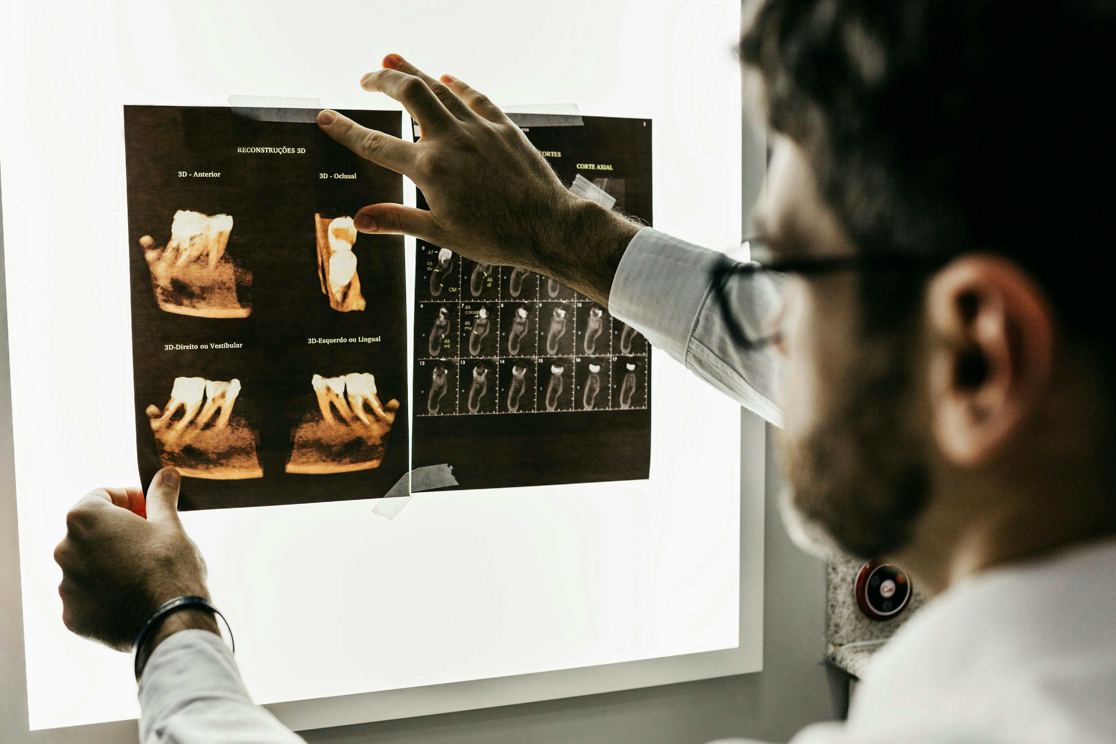 a dentist is looking at an x-ray of a patient 's teeth .
