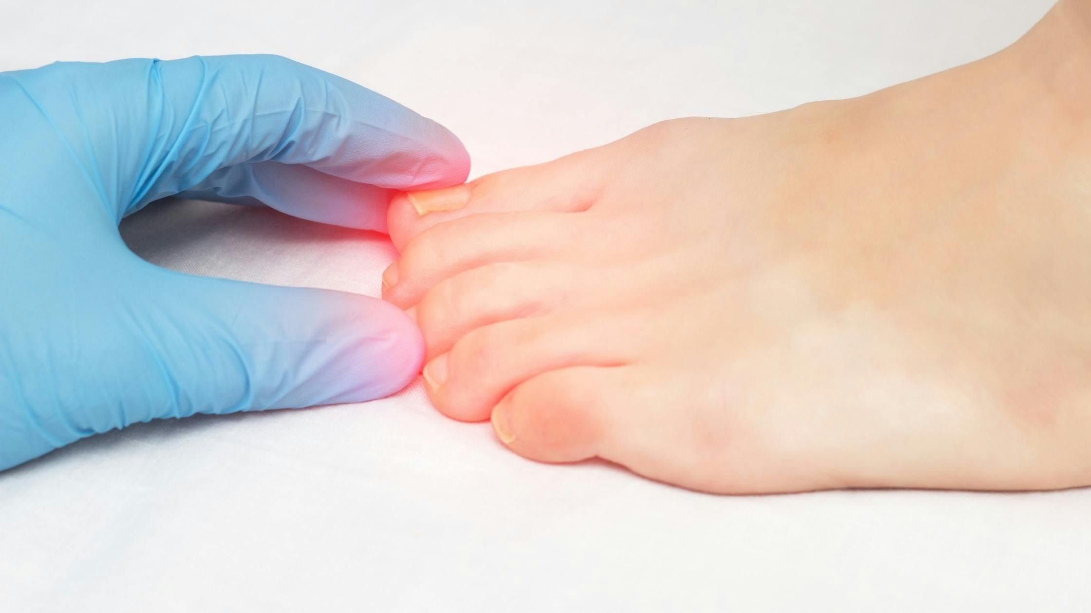 a close up of a person 's foot being examined by a doctor .