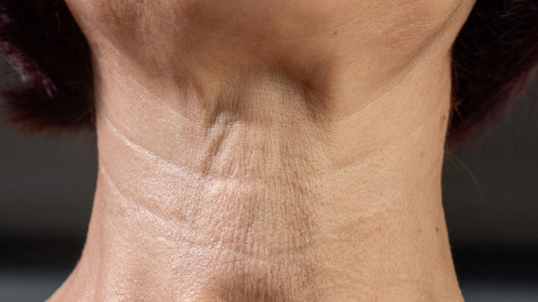 a close up of a woman 's neck with wrinkles .