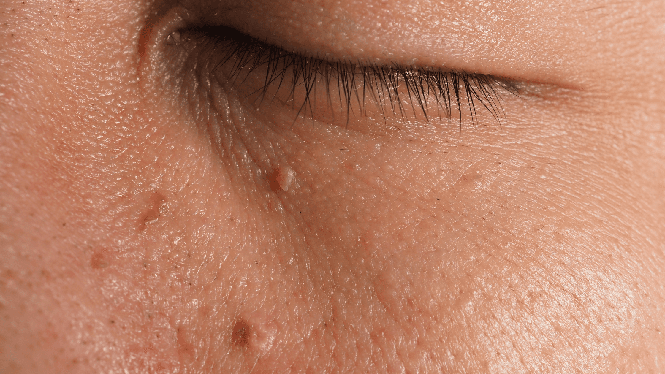 a close up of a woman 's face with her eye closed