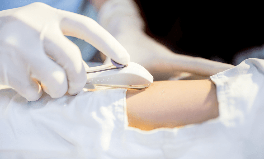 A gloved hand holds a medical device against a person's arm.