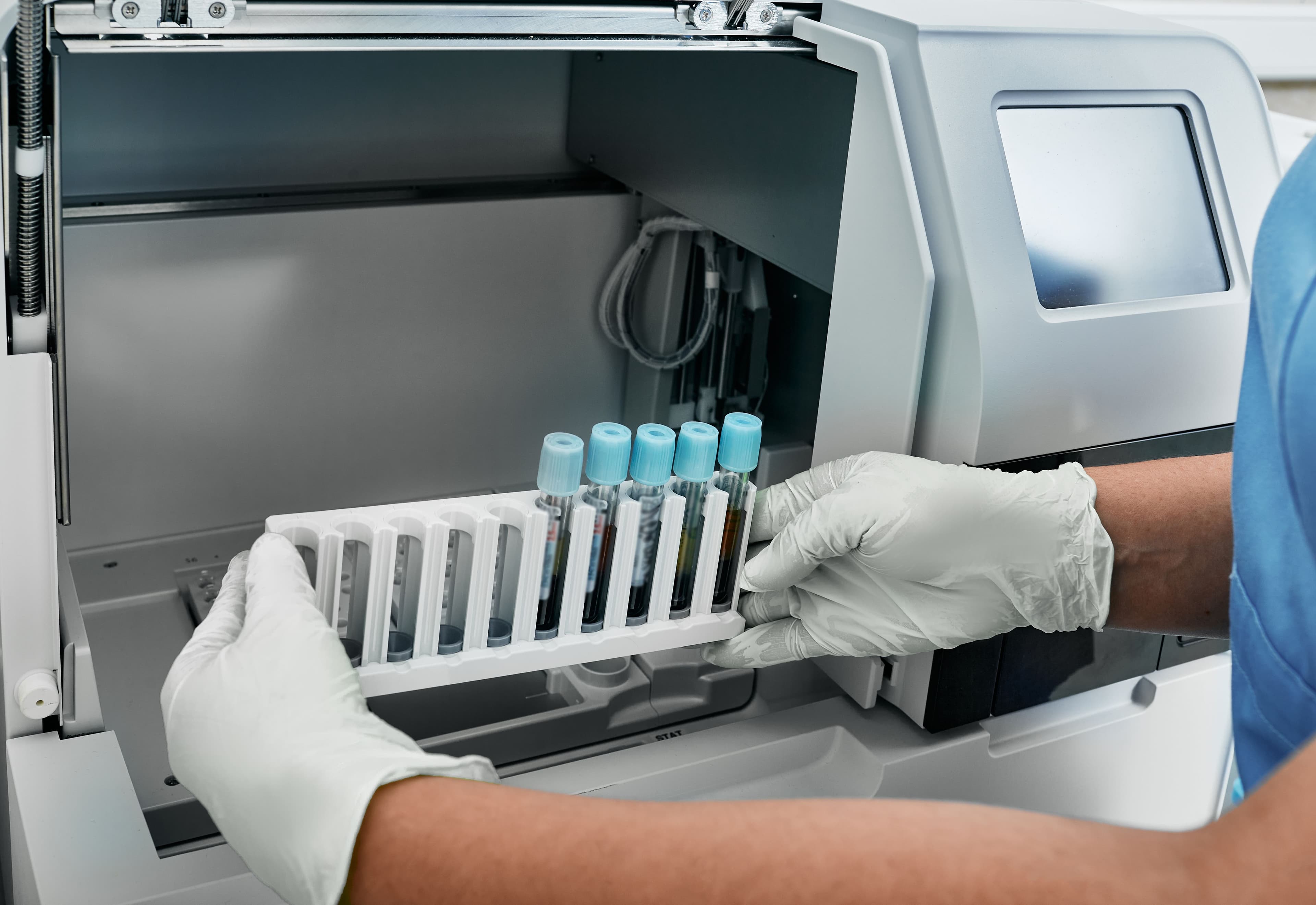 Southeast Medical Group now offers in-house lab work at select clinics.