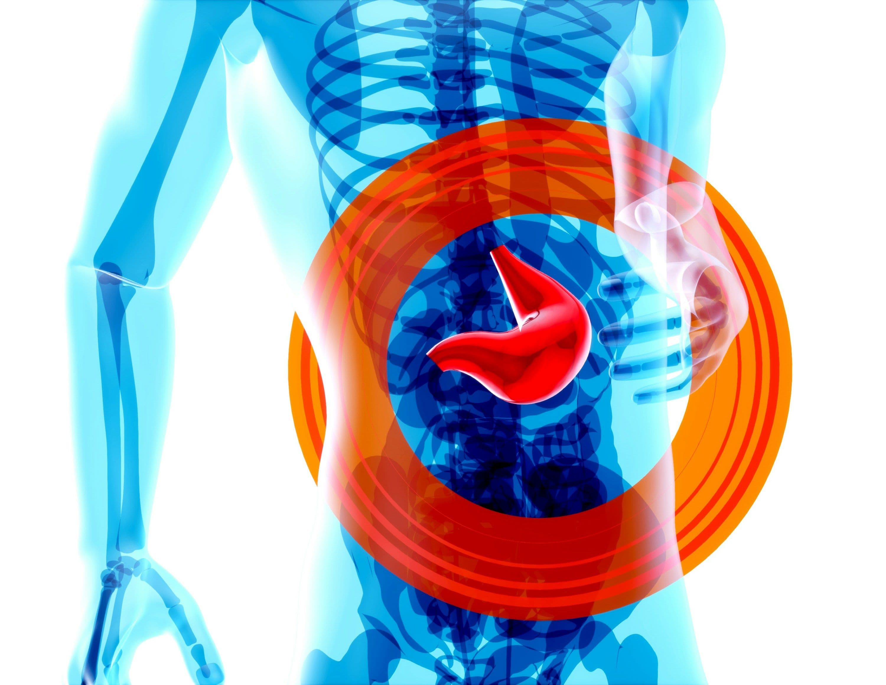 A transparent blue human torso with a red stomach highlighted by radiating red and orange pain circles.